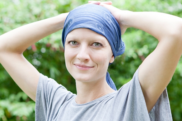Photo of female cancer patient